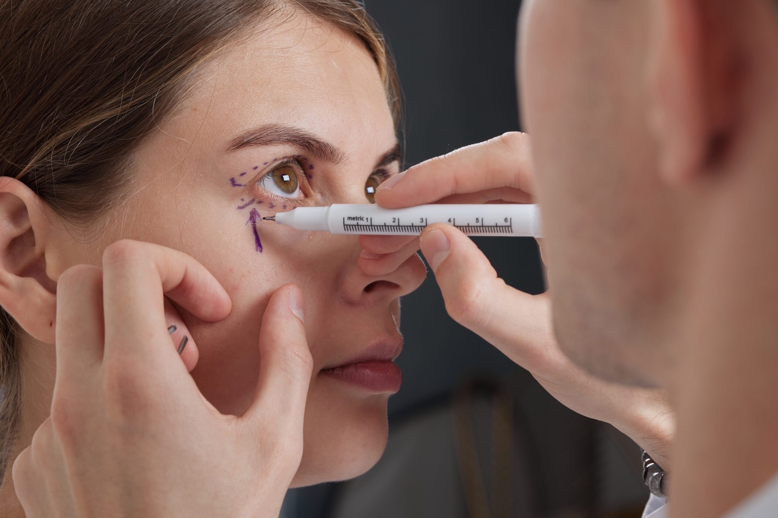 Plastic surgeon prepares patient for Blepharoplasty procedure,